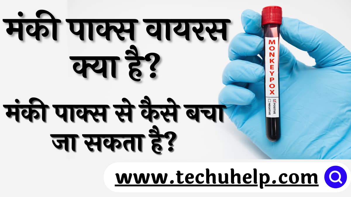 मंकी पाक्स वायरस क्या है? इसके लक्षण क्या हैं? मंकी पाक्स से कैसे बचा जा सकता है?