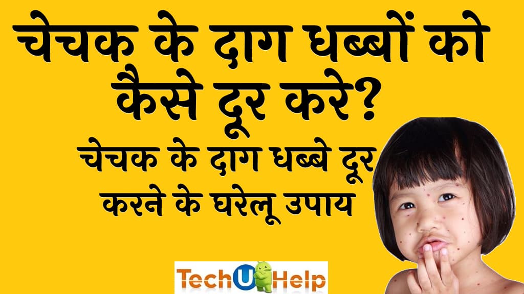 चेचक के दाग धब्बों को कैसे दूर करे चेचक के दाग धब्बे दूर करने के घरेलू उपाय Chechak ke nishan kaise mitaye