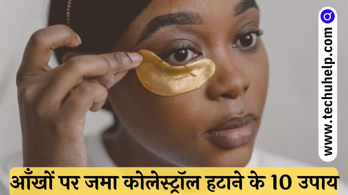 आँखों पर जमा कोलेस्ट्रॉल हटाने के 10 उपाय | Eye cholesterol treatment in Hindi