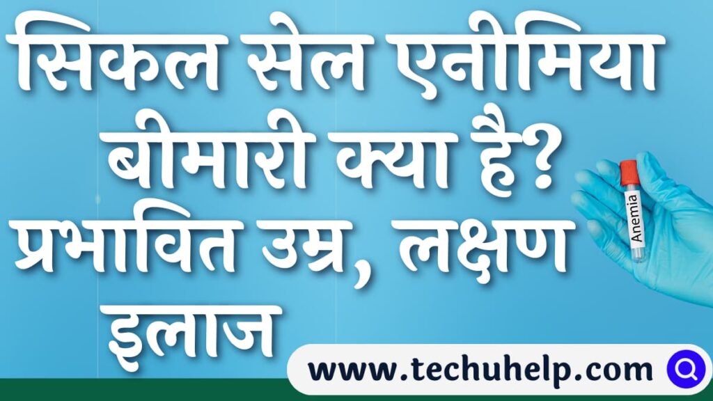 सिकल सेल एनीमिया क्या है? इसके लक्षण क्या हैं? इस बीमारी का इलाज क्या है? यह बीमारी किस उम्र से शुरू होती है?